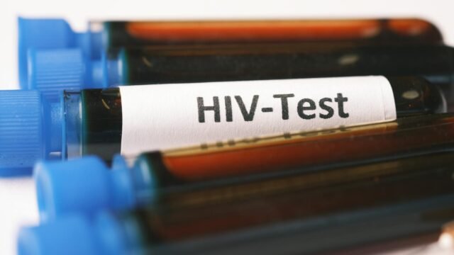 A Single Infusion Could Suppress H.I.V. for Years, Study Suggests