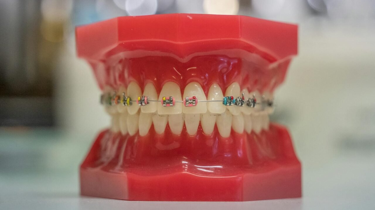 Beyond Aesthetics: Orthodontics’ Crucial Role in Overall Health and Well-being