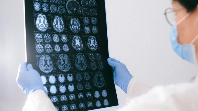 Changes in body fat due to obesity can contribute to Alzheimer’s disease: Study