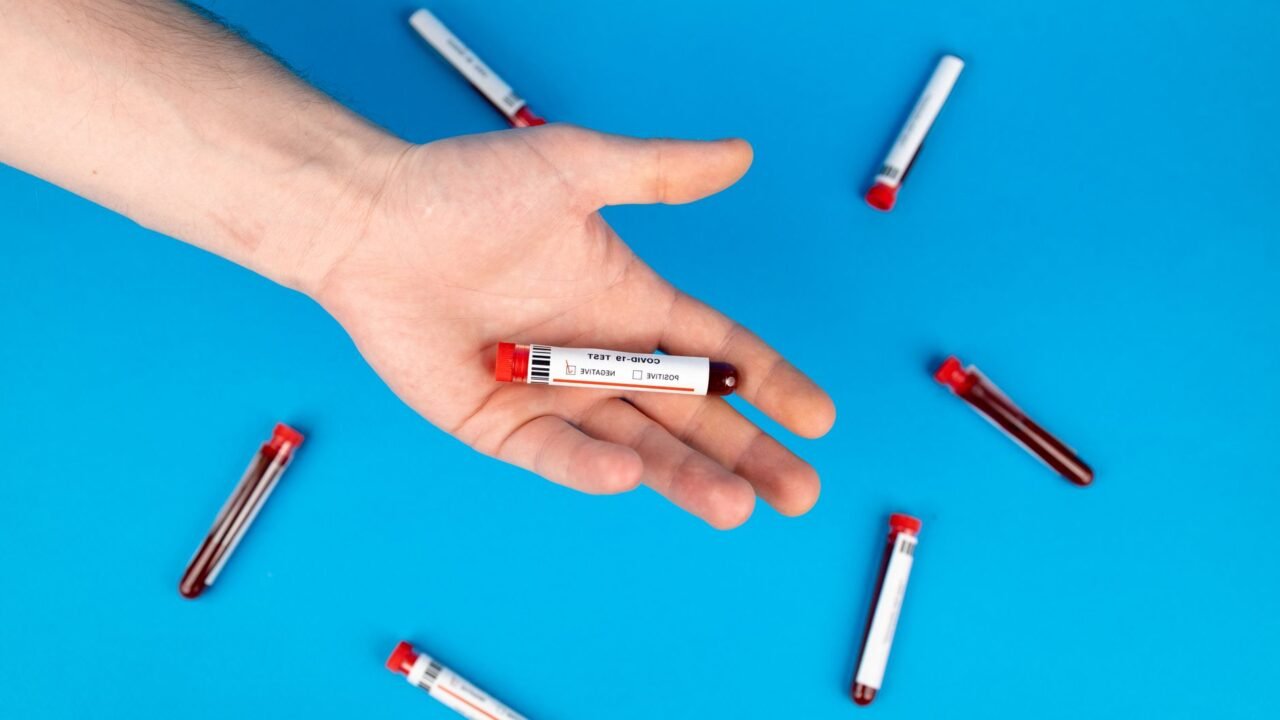 Dutch Virologist Detained at US Airport with Mpox Virus Samples