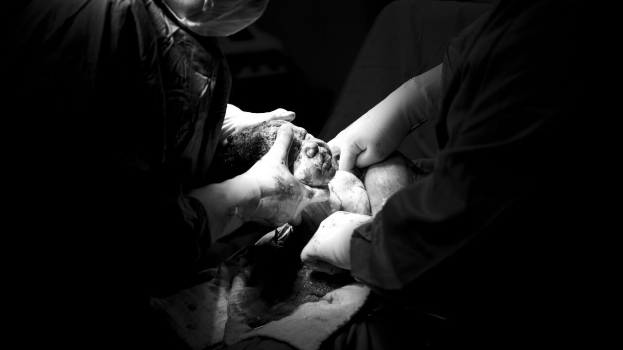 Jammu Surgeons Achieve Rare Laparoscopic Adrenal Tumor Removal in Teen