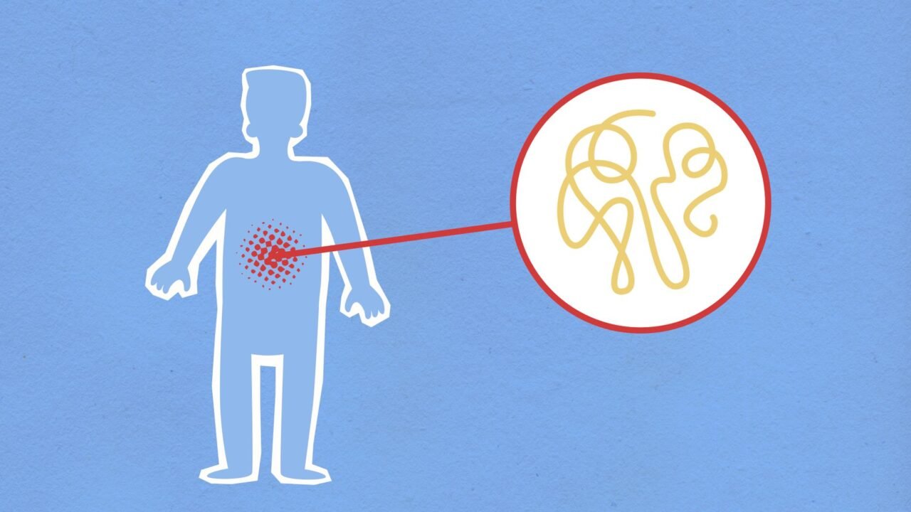 Kenya Confirms First Ebola Case Following Traveler’s Arrival