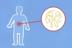 Kenya Records Ebola Case for First Time